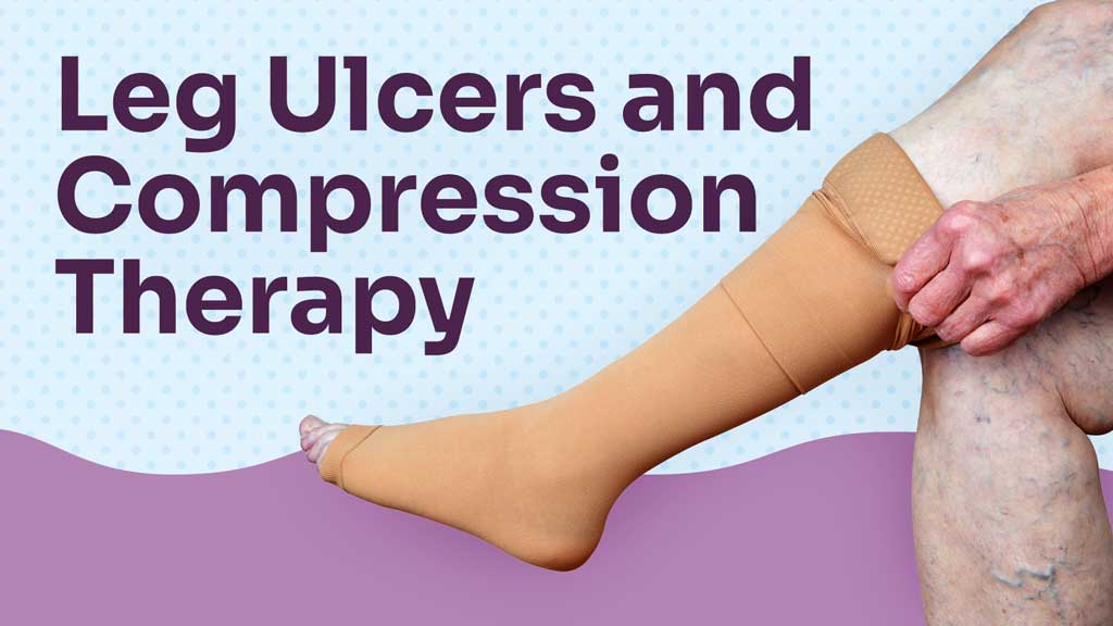 Compression therapy veins vein varicose benefit issues those decrease insufficiency venous experience pain active due lifestyle live if may