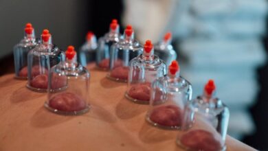 Cupping is trending but does it help recovery