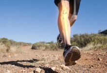 Why running and walking is unlikely to ruin your knees