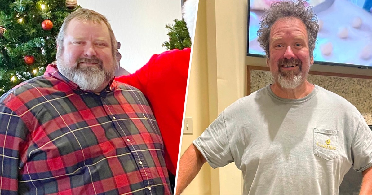 Chris 113 pound weight loss literally saved life motorcycle accident