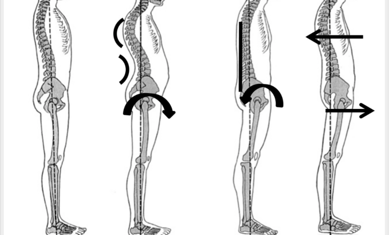 5 surprising benefits of good posture