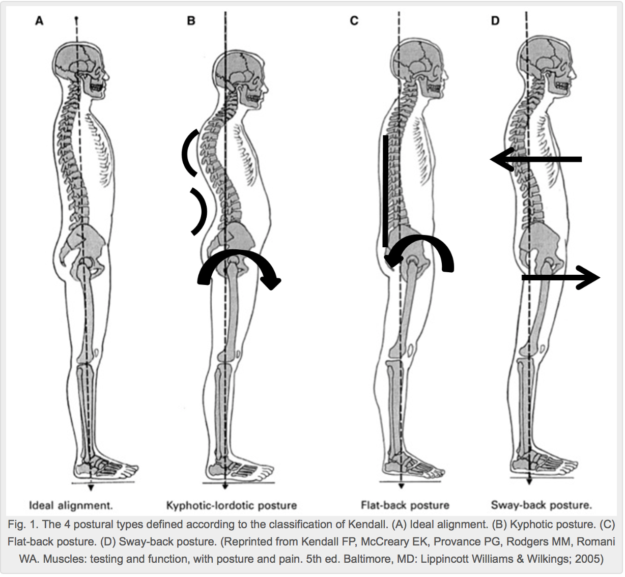 5 surprising benefits of good posture