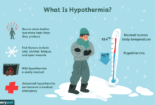 How to deal with hypothermia