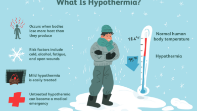 How to deal with hypothermia