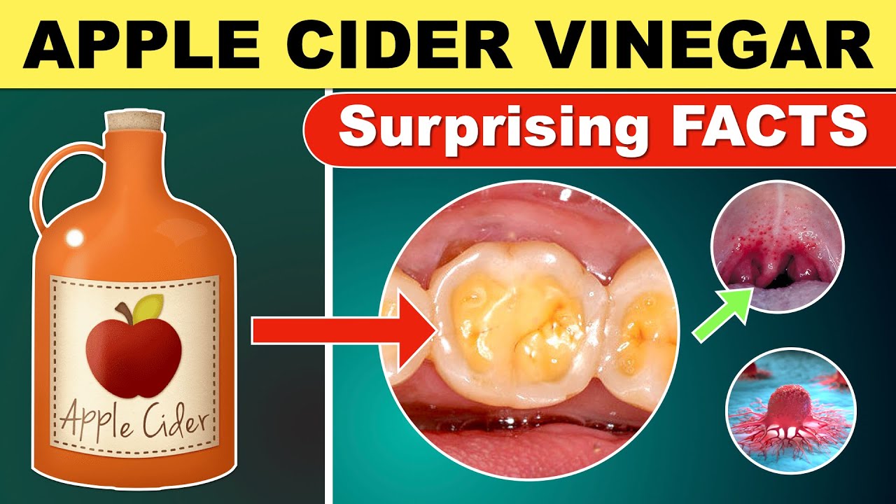 Nutrition scientist on apple cider vinegar for weight loss