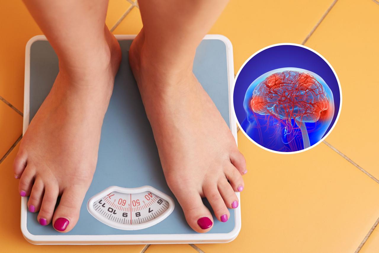 3 ways weight loss changes your brain