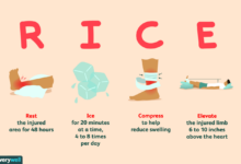 Should you still treat injuries using rice