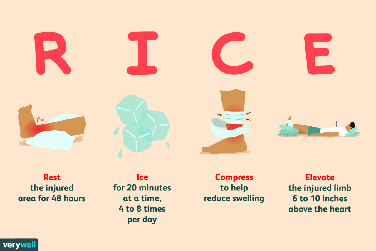 Should you still treat injuries using rice